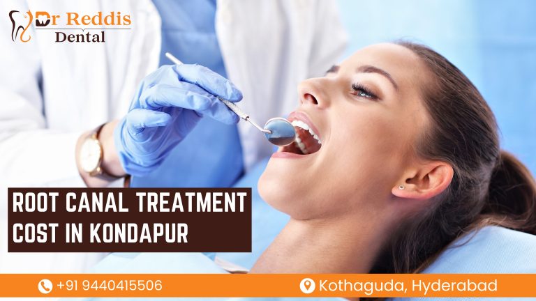 Root Canal Treatment Cost in Kondapur – Dr Reddis Dental Clinic