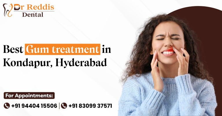 Best Gum Treatment in Kondapur, Hyderabad – Dr Reddis Dental Clinic
