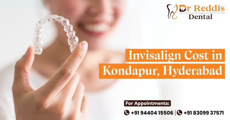 Invisalign Cost in Kondapur, Hyderabad – Dr. Reddis Dental Clinic