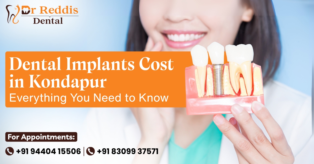 Dental Implants Cost in Kondapur – Everything You Need to Know | Dr.Reddis Dental