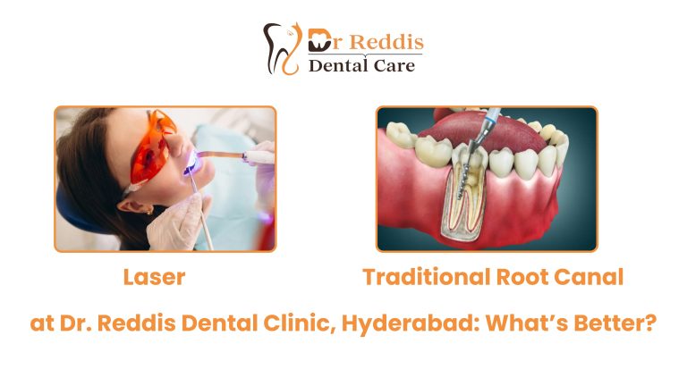 Laser vs Traditional Root Canal at Dr. Reddis Dental Clinic, Hyderabad: What’s Better?