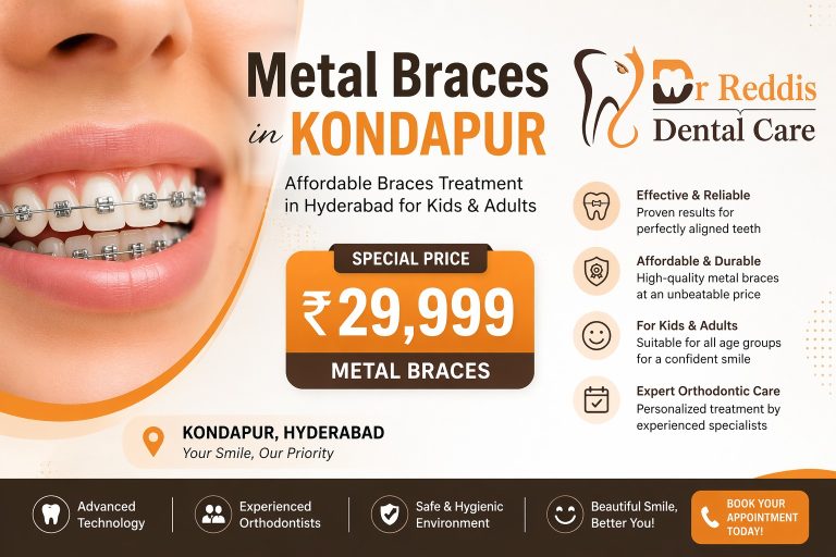 🦷 Metal Braces in Kondapur at ₹29,999 – Affordable Braces Treatment in Hyderabad for Kids & Adults