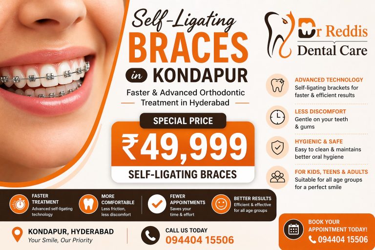 🦷 Self-Ligating Braces in Kondapur at ₹49,999 – Faster & Advanced Orthodontic Treatment in Hyderabad