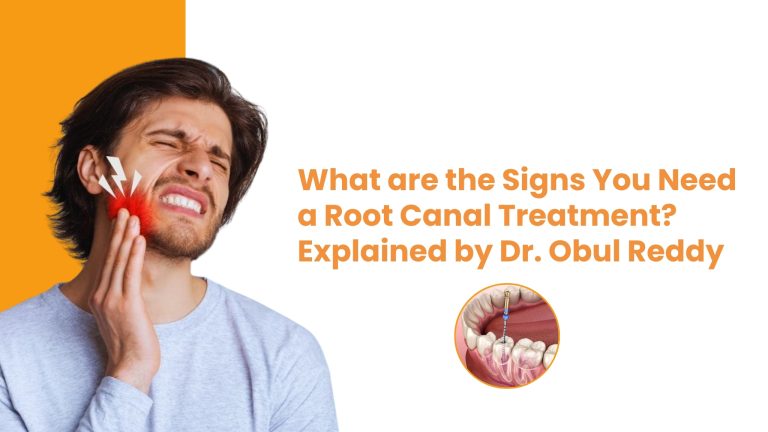 What Are the Signs You Need a Root Canal Treatment? Explained by Dr. Obul Reddy | Dr. Reddis Dental Clinic