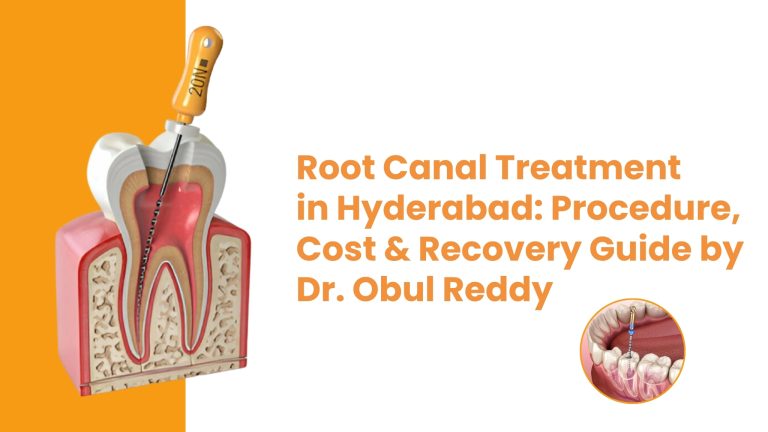 Root Canal Treatment in Hyderabad: Procedure, Cost & Recovery Guide by Dr. Obul Reddy | Dr. Reddis Dental Clinic