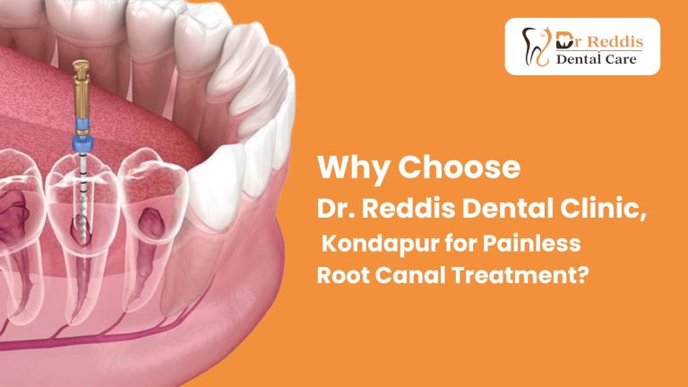 Why Choose Dr. Reddi’s Dental Clinic, Kondapur for Painless Root Canal Treatment?