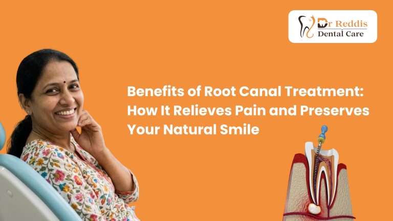 Benefits of Root Canal Treatment: How It Relieves Pain and Preserves Your Natural Smile