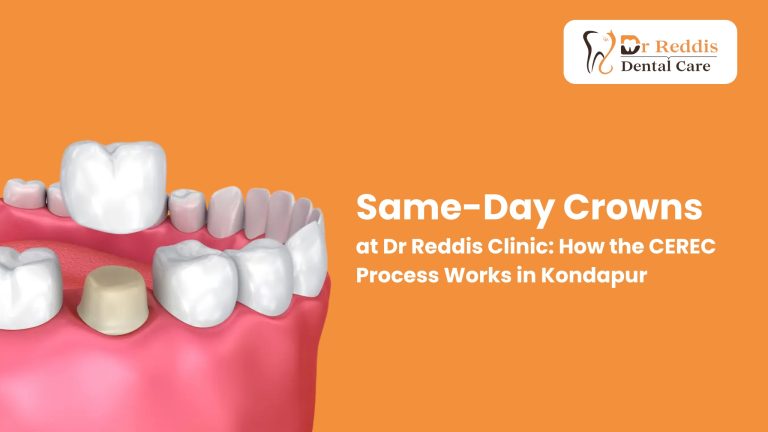 Same-Day Crowns at Dr Reddis Clinic: How the CEREC Process Works in Kondapur