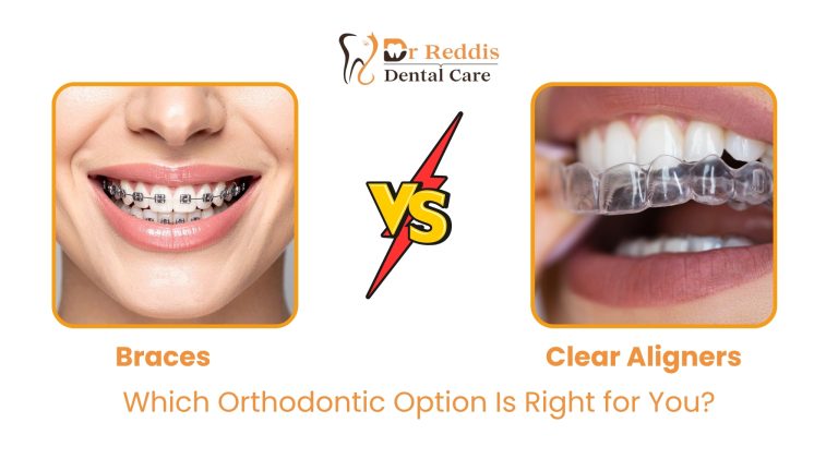 Braces vs. Clear Aligners: Which Orthodontic Option Is Right for You?