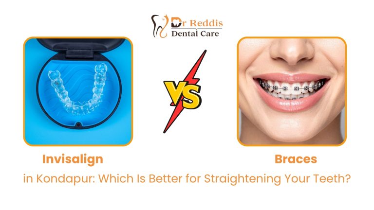 Invisalign vs Braces in Kondapur: Which Is Better for Straightening Your Teeth?