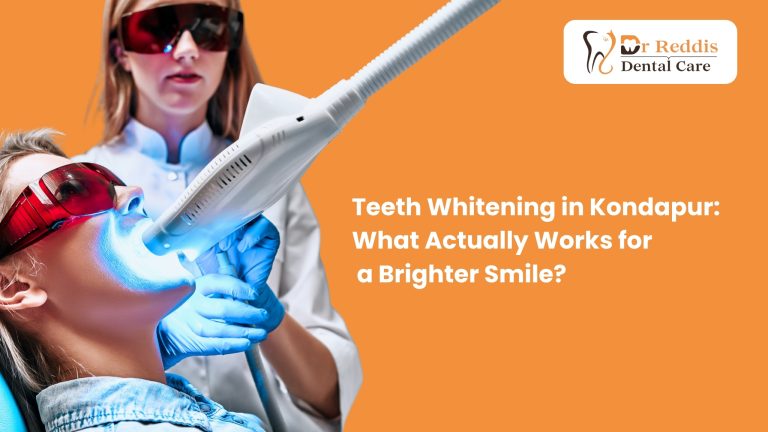 Teeth Whitening in Kondapur: What Actually Works for a Brighter Smile?