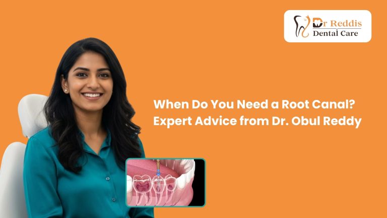 When Do You Need a Root Canal? Expert Advice from Dr. Obul Reddy
